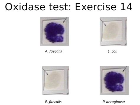 e.coli oxidase test